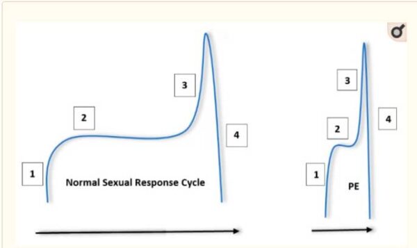 premature ejaculation explained in image