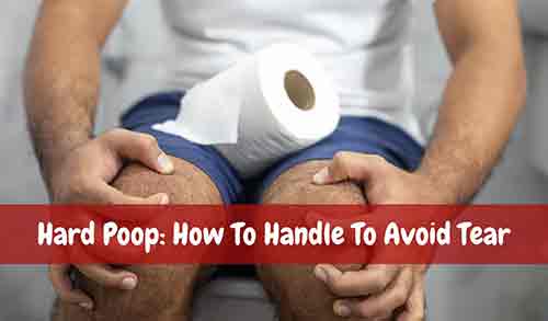 hard poop: how to handle to avoid tear