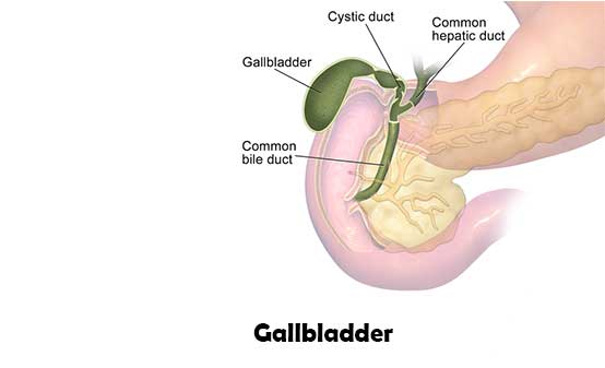 relationship between ulcer and gallstone