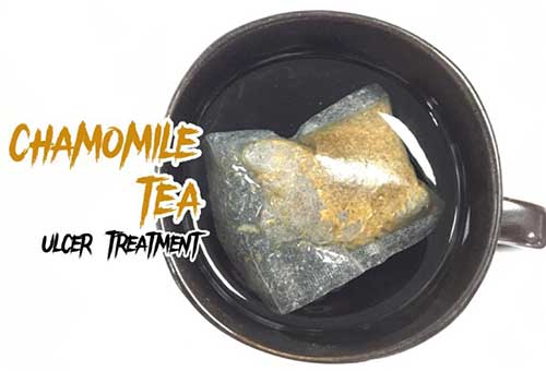 chamomile for ulcer treatment