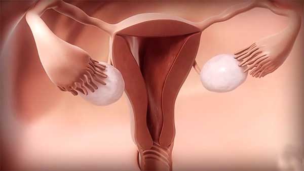 hsg test Hysterosalpingogram procedure for fallopian tube.