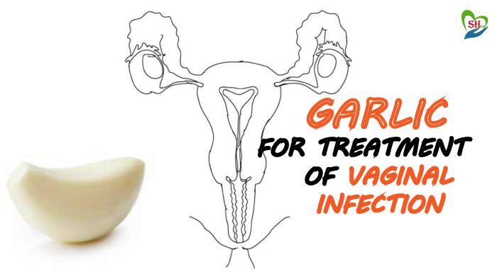 garlic for treatment of vaginal infection