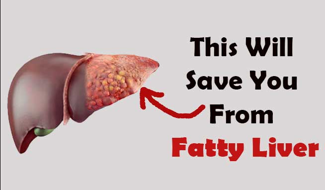 Fatty Liver natural treatment