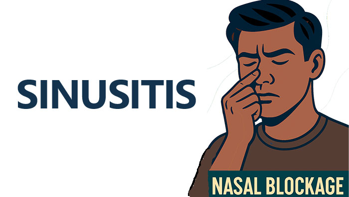 nasal Blockage